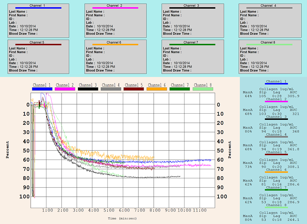 CHRONO-LOG Model 490 4+4 Aggregation with AGGRO/LINK® Opti8